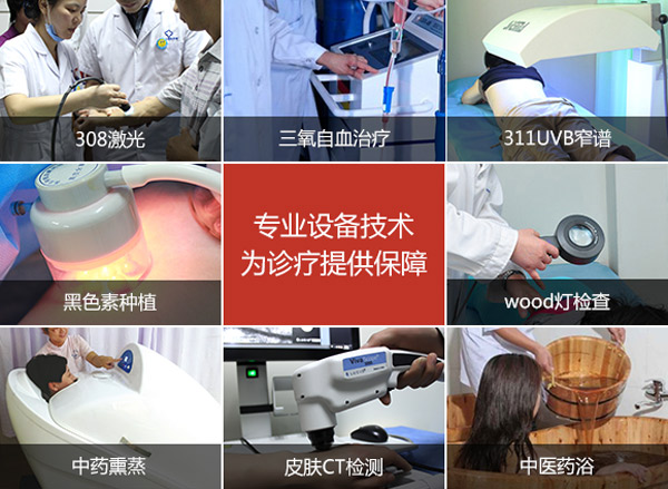 预防白癫风要做到哪几点