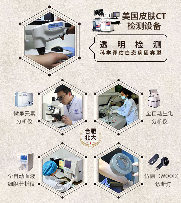 腿部白癜风的护理方法有哪些